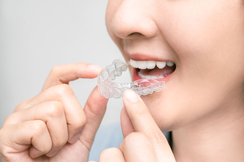 gouttières transparentes orthodontie Forezdent Montbrison